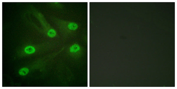 Acetyl p53 (K386) Polyclonal Antibody – Figure 1 of 1
