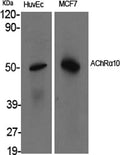 AChR Alpha10 Polyclonal Antibody – Figure 1 of 1