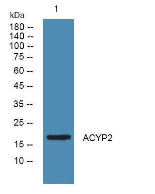 ACYP2 Polyclonal Antibody – Figure 1 of 1
