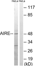 AIRE-1 Polyclonal Antibody – Figure 1 of 1