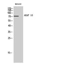 AKAP 10 Polyclonal Antibody – Figure 1 of 1
