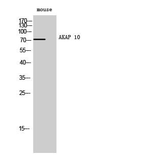 AKAP 10 Polyclonal Antibody – Figure 1 of 1