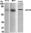 AKAP 95 Polyclonal Antibody – Figure 1 of 1