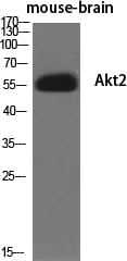 Akt2 Polyclonal Antibody – Figure 1 of 1