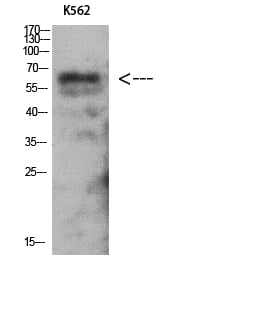 AMPK Gamma2 Polyclonal Antibody – Figure 1 of 1