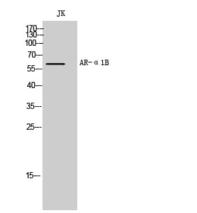 AR- Alpha1B Polyclonal Antibody – Figure 1 of 1