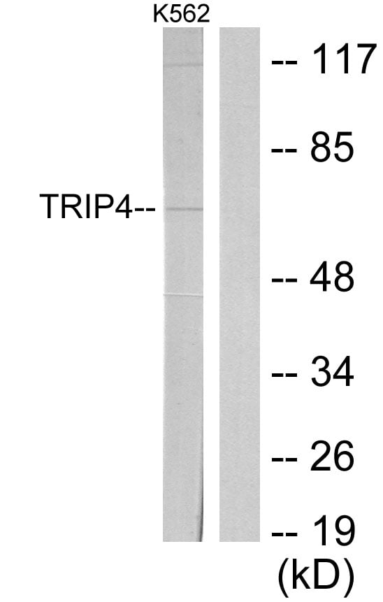 ASC-1 Polyclonal Antibody – Figure 1 of 1