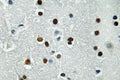 ASCL1 Polyclonal Antibody – Figure 1 of 1