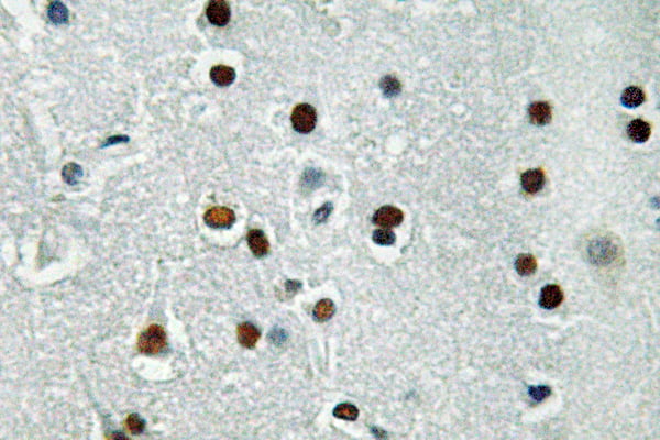 ASCL1 Polyclonal Antibody – Figure 1 of 1