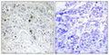 B-ATF Polyclonal Antibody – Figure 1 of 1