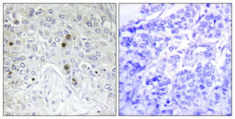 B-ATF Polyclonal Antibody – Figure 1 of 1