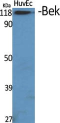 Bek Polyclonal Antibody – Figure 1 of 1