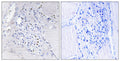 BinCARD Polyclonal Antibody – Figure 1 of 1