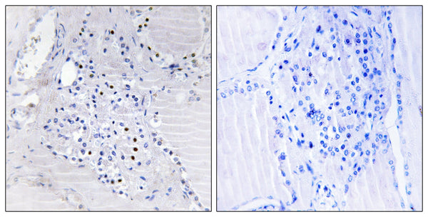 BinCARD Polyclonal Antibody – Figure 1 of 1