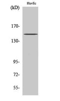 BRCAA1 Polyclonal Antibody – Figure 1 of 1