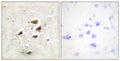CaMKII Alpha/Beta/Delta Polyclonal Antibody – Figure 1 of 1