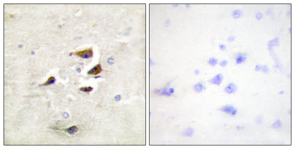 CaMKII Alpha/Beta/Delta Polyclonal Antibody – Figure 1 of 1