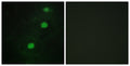 CCRK Polyclonal Antibody – Figure 1 of 1