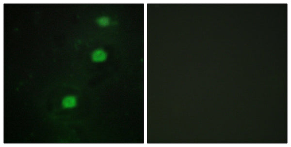 CCRK Polyclonal Antibody – Figure 1 of 1