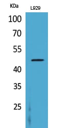 CD116 Polyclonal Antibody – Figure 1 of 1