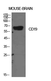 CD19 Polyclonal Antibody – Figure 1 of 1