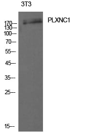 CD232 Polyclonal Antibody – Figure 1 of 1