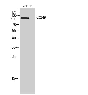 CD249 Polyclonal Antibody – Figure 1 of 1