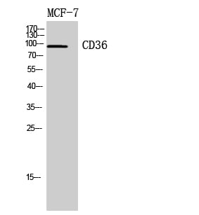 CD36 Polyclonal Antibody – Figure 1 of 1