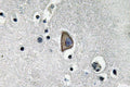 CD3-Epsilon Polyclonal Antibody – Figure 1 of 1