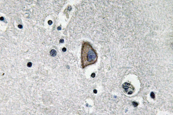 CD3-Epsilon Polyclonal Antibody – Figure 1 of 1