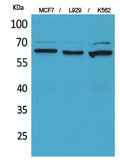 CD6 Polyclonal Antibody – Figure 1 of 1