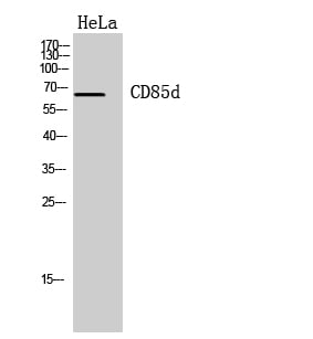 CD6 Polyclonal Antibody – Figure 1 of 1