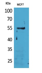 CD63 Polyclonal Antibody – Figure 1 of 1