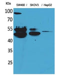 CD63 Polyclonal Antibody – Figure 1 of 1