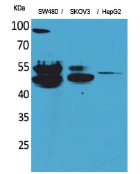 CD63 Polyclonal Antibody – Figure 1 of 1