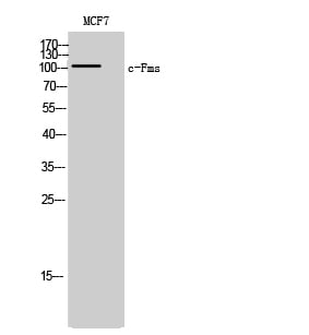 CD63 Polyclonal Antibody – Figure 1 of 1