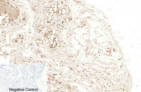 CD57 Polyclonal Antibody – Figure 1 of 1
