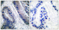 CD58 Polyclonal Antibody – Figure 1 of 1