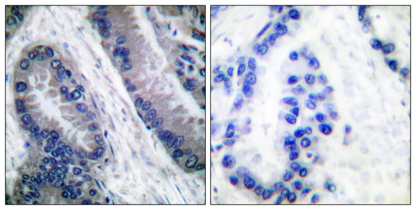 CD58 Polyclonal Antibody – Figure 1 of 1