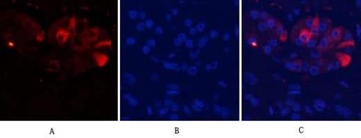 CD55 Polyclonal Antibody – Figure 1 of 1
