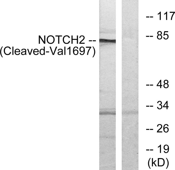 CD57 Polyclonal Antibody – Figure 1 of 1