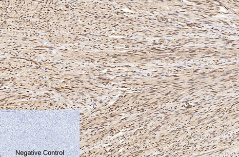CD59 Polyclonal Antibody – Figure 1 of 1