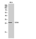 CD58 Polyclonal Antibody – Figure 1 of 1
