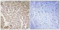 CD56 Polyclonal Antibody – Figure 1 of 1