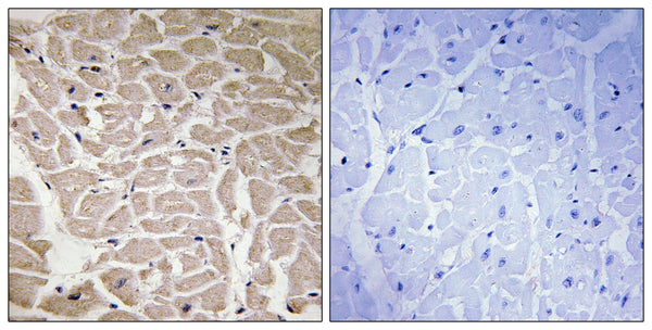 CD56 Polyclonal Antibody – Figure 1 of 1