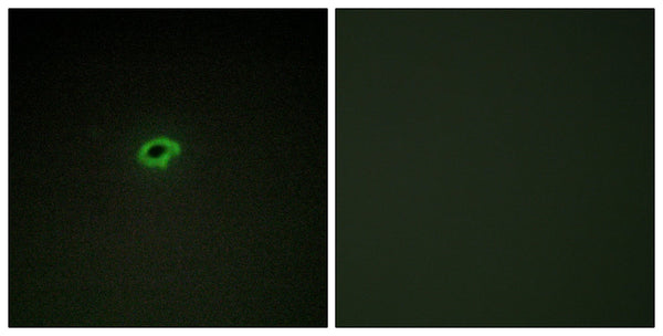 CD58 Polyclonal Antibody – Figure 1 of 1
