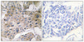 CD57 Polyclonal Antibody – Figure 1 of 1