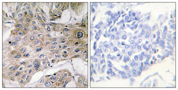 CD57 Polyclonal Antibody – Figure 1 of 1