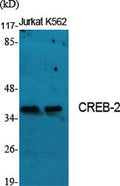 CD58 Polyclonal Antibody – Figure 1 of 1