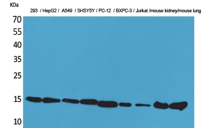 CD6 Polyclonal Antibody – Figure 1 of 1